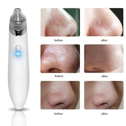 Electric-USB-Charge-Vacuum-Blackhead-Removal-Acne-Blemish-Remover-Device-Blackhead-Extractor-Nose-Blackhead-Cleaner-Tool.jpg